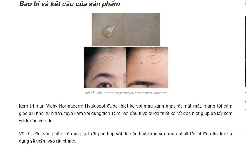 Kem trị mụn trứng cá Vichy