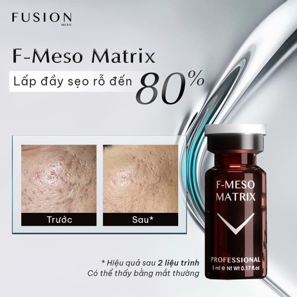 f-meso matrix tăng cường hiệu quả điều trị sẹo